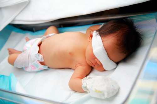 baby with jaundice treatment